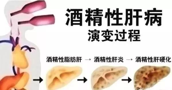 为什么有的人喝酒很伤肝，有的人却没事？