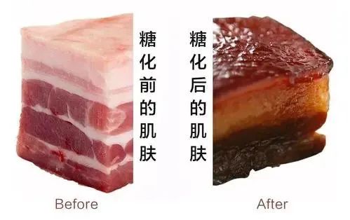 年轻人新的养生潮流——戒糖!